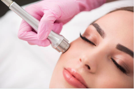 microdermabrasion-skin-nyc